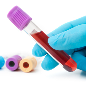 genetic-testing Genetic testing for Labradors