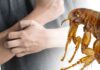 can fleas live on humans